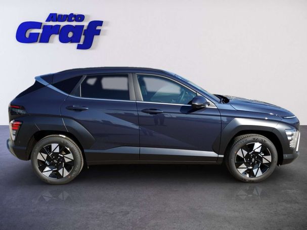 Hyundai Kona Trend 104 kW image number 3