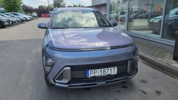 Hyundai Kona 88 kW image number 3