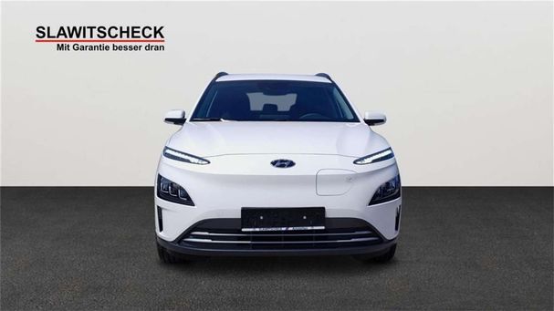 Hyundai Kona Elektro Trend 150 kW image number 6