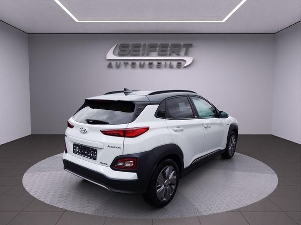 Hyundai Kona Elektro 150 kW image number 2