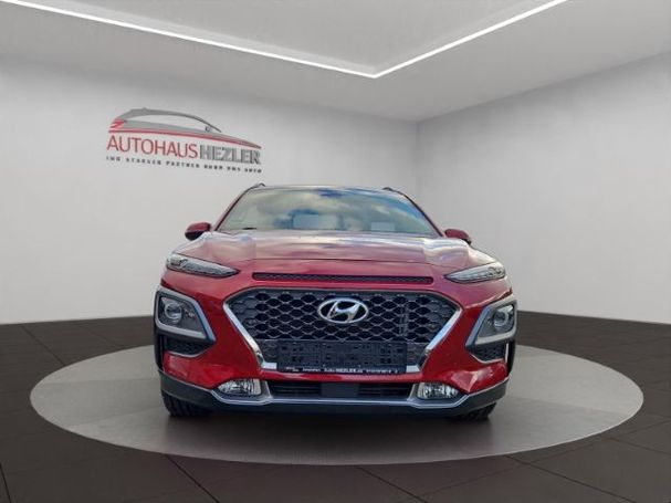 Hyundai Kona 1.0 T-GDI 88 kW image number 8