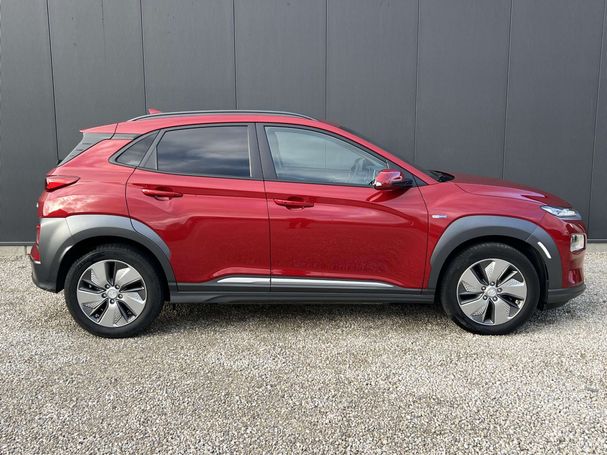 Hyundai Kona 64 kWh 150 kW image number 4