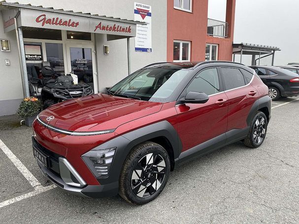 Hyundai Kona 1.6 GDI Hybrid Trend DCT 95 kW image number 1