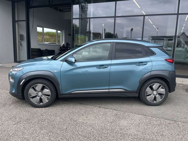 Hyundai Kona Elektro 64 kWh 150 kW image number 5