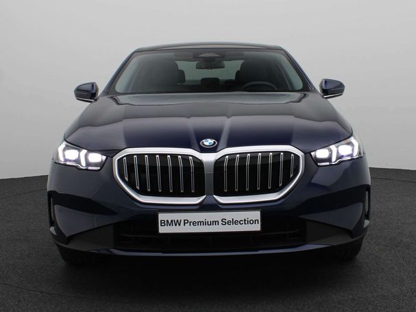 BMW 520i 153 kW image number 2