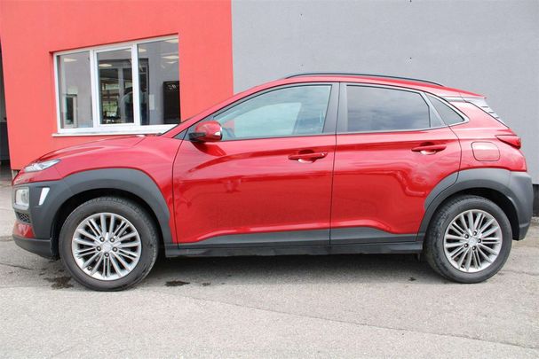 Hyundai Kona 1.6 CRDi DCT 4WD 100 kW image number 3